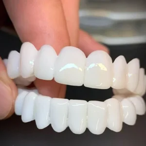 Kosmetische Zahn-Topper SmileShape – Wiederverwendbar, Flexibel und Natürlich Weiß | Karnz